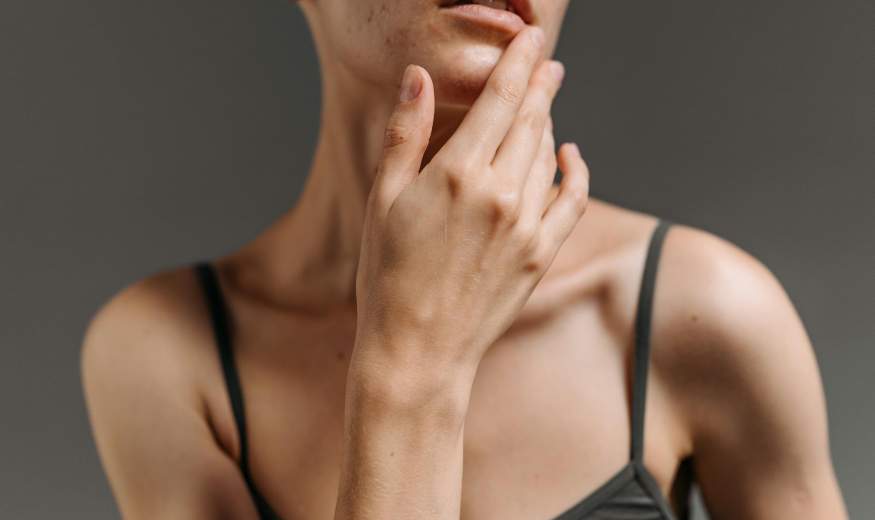 Hormonálna nerovnováha a význam organického jódu